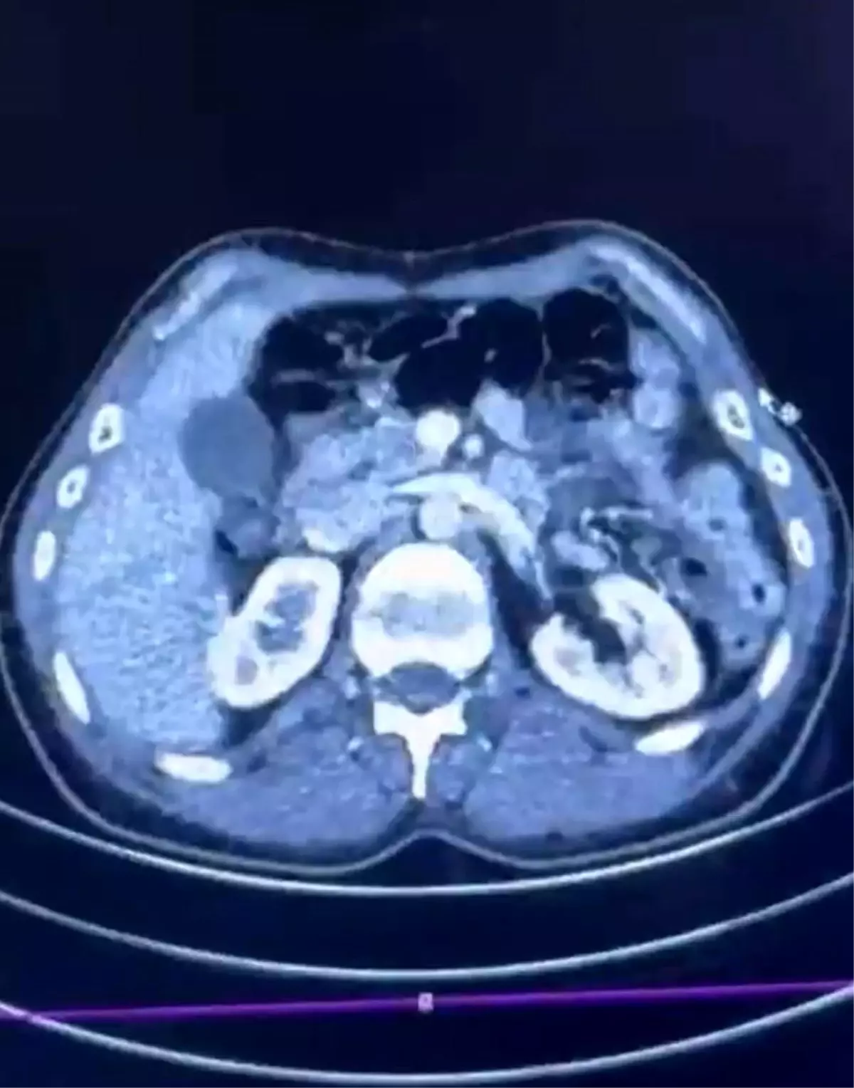 Kayseri'de Uyuşturucu Operasyonu: 554 Gram Ele Geçirildi