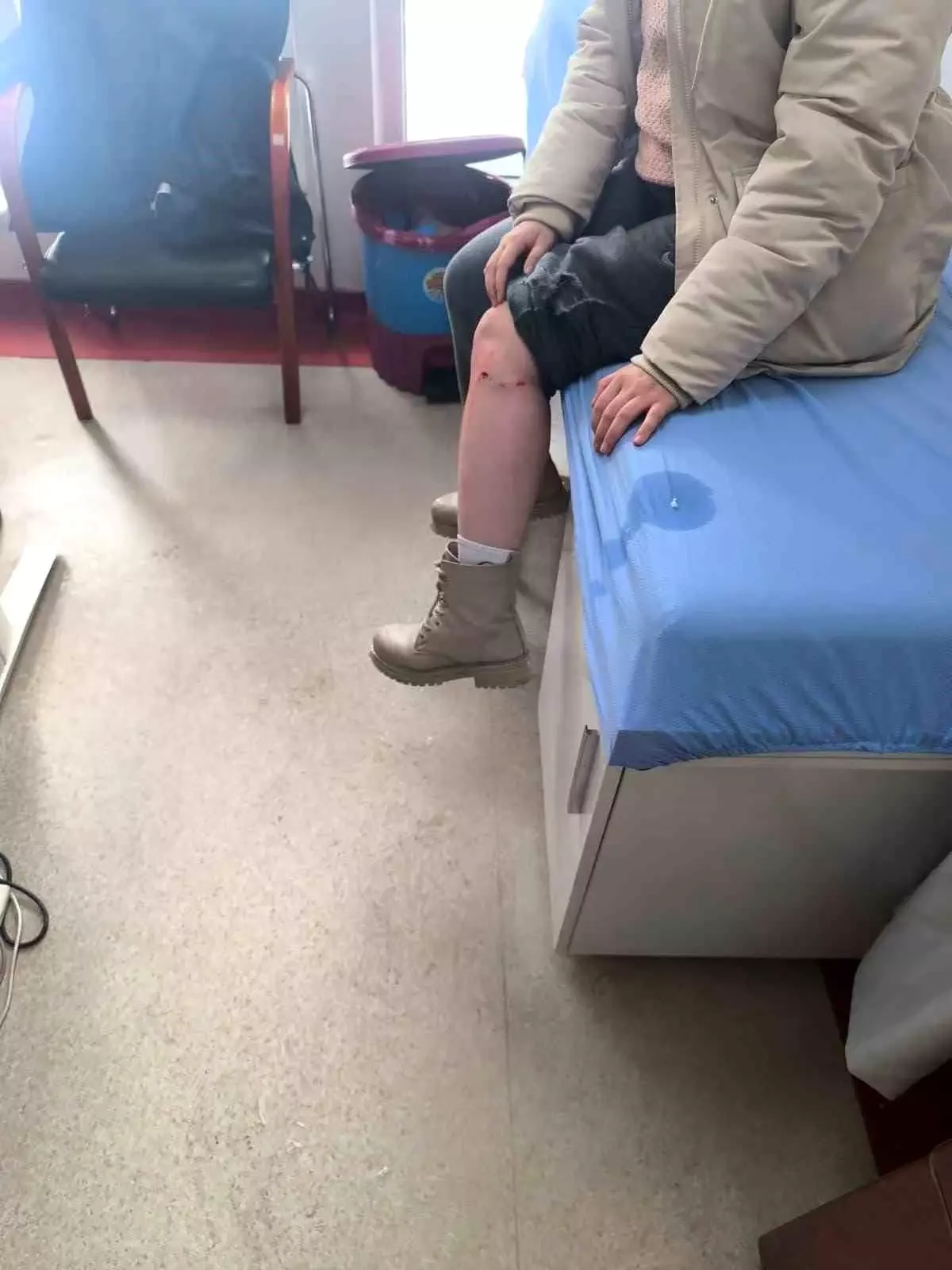 Kayseri'de Sokak Köpeği Kız Çocuğunu Yaraladı